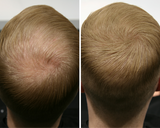 Top Fiber Ennen ja jälkeen kuvat